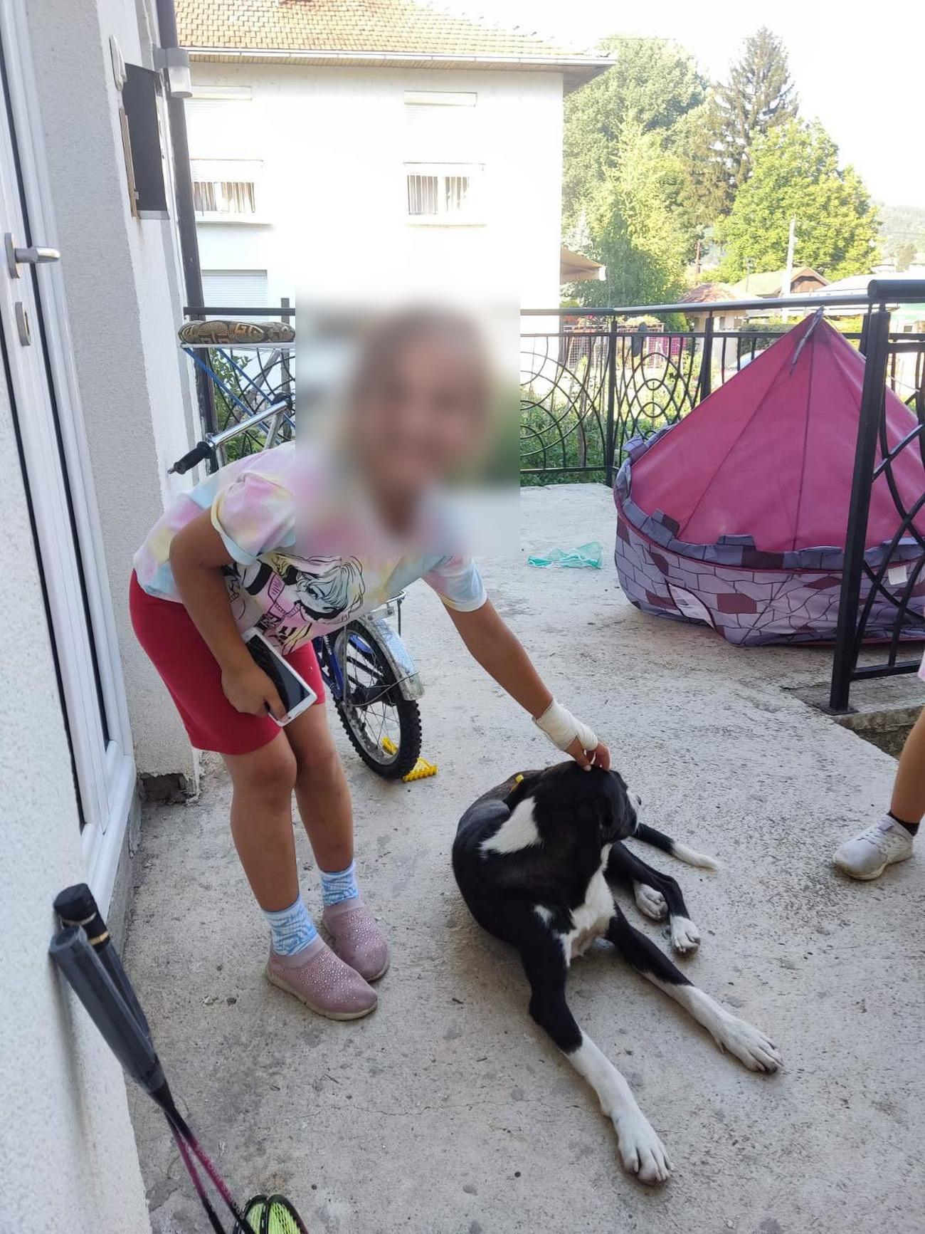 Pas lutalica napao devojčicu u Prijepolju: Izujedao je za nogu, ruku i leđa (FOTO)